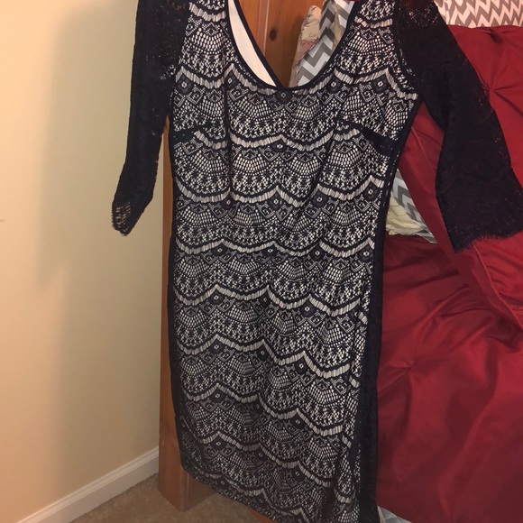 Blue Lace Homecoming Dress - Picture 4 of 4